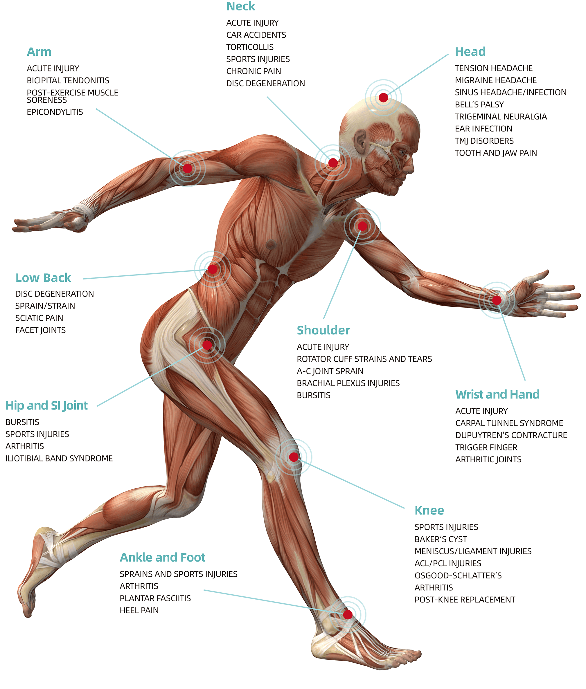 Diagram of the body showing common areas treated with laser therapy, including neck, low back, shoulder, hip, knee, and more