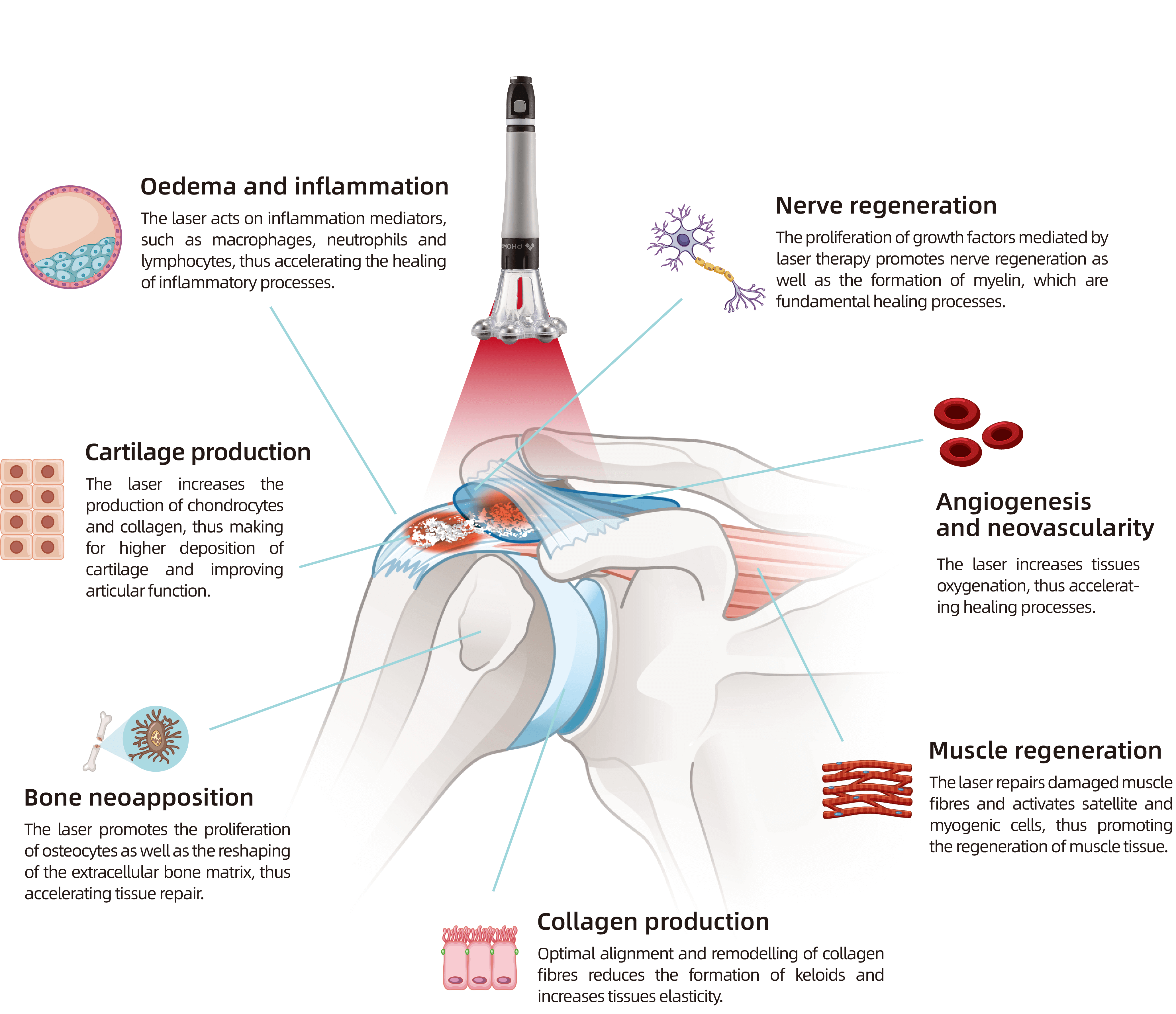 Diagram showing how Class IV laser therapy affects inflammation, nerve regeneration, blood flow, cartilage, bone, and muscle tissue