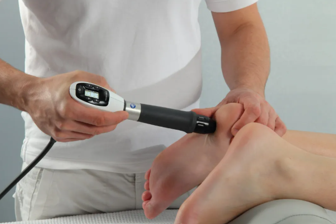 Shockwave therapy device being applied to the heel and arch of a patient's foot for plantar fasciitis